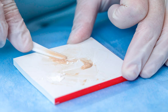 dental glass ionomer dental glass ionomer