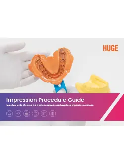 HUGE PERFIT Impression Guide & Troubleshooting